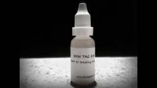 Skin Tag Remover  removing skin tags the natural way Skin Tag Zap [upl. by Atwater283]