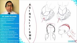 Distocias  Maniobras USAMEDIC  Obstericia 5 [upl. by Eelrac]