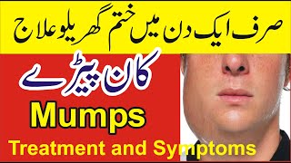 Kan Pere Ka Ilaj  Mumps Treatment in Urdu  Kanfed ka ilaj  Kan Paray ka ilaj [upl. by Losyram]