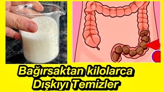 Bir gecede 3 kilo verdiriyor kolon temizliği bağırsak kıvrımlarını temizler [upl. by Norre464]