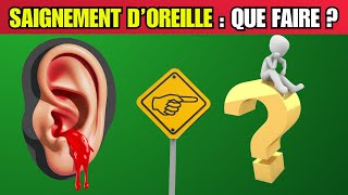 Votre Oreille Saigne après Nettoyage  Découvrez les DANGERS Cachés  🚨👂❗ Santé BienÊtre [upl. by Malloch]