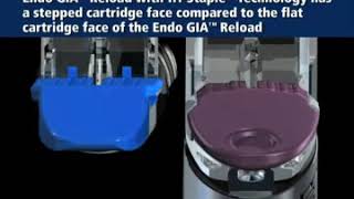 Endo GIA Ultra  Endo GIA Tri Staple CovidienMedtronic [upl. by Hopkins936]