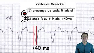 Eletrocardiograma  taquicardias QRS largo  análise ECG [upl. by Bonnes]