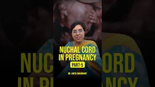 nuchal cord in pregnancy explained pregnancycomplications pregnancytips pregnancy [upl. by Lula]