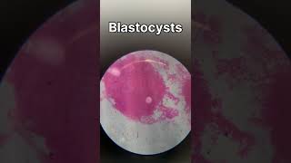 TS of ovary  TS of testis  ringworm bacteria under microscope biology animalkingdomclass11 [upl. by Eiuqcaj810]