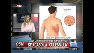 C5N  SALUD LLEGA LA VACUNA CONTRA EL HERPES ZOSTER [upl. by Talich]