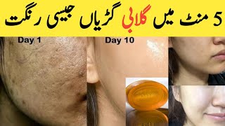 Whitening Soap For Whitening Glowing Skin  How to Make Whitening Soap At Home  Instant whitening [upl. by Akinert]