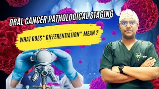 Dr Rudra Mohan Histopathological Staging  Differentiation Of Oral Cancer  Simplified at a glance [upl. by Avid671]