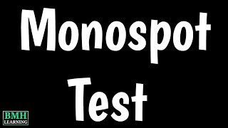 Mononucleosis Spot Test  Monospot Test  Rapid Mono Test  EBV Testing [upl. by Anitroc]