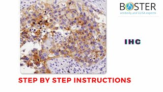 Immunohistochemistry IHC  Step by step instructions [upl. by Buddie441]