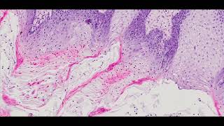 The tongue with filiform and circumvallate papillae  PUMS Histology Slides Review Series [upl. by Siddra]