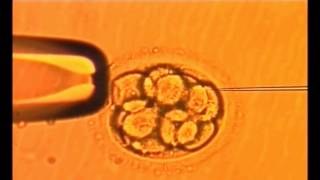 Assisted Embryo Hatching [upl. by Flight688]