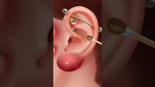 Ear cleaning ASMR treatment  asmr earcleaning earcleaningasmr shorts [upl. by Avehstab]