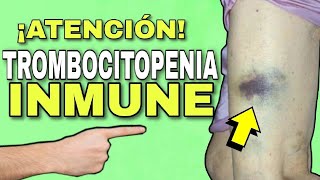 TROMBOCITOPENIA INMUNE💢 FISIOPATOLOGÍA SINTOMAS CAUSAS DIAGNÓSTICO y TRATAMIENTO📌 [upl. by Wilt]