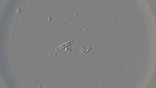 Diatoms in action [upl. by Hselin]