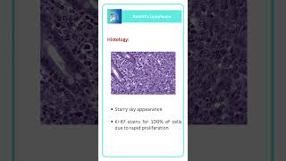 Burkitts Lymphoma  PATHOLOGY MEDICINE RAPID REVISION [upl. by Granniah880]