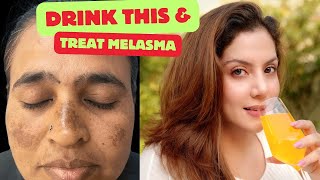 Drink this to treat Melasma amp Pigmentation  Nipun Kapur [upl. by Edylc]