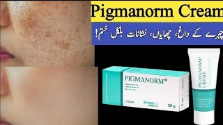 How to use Pigmanorm Cream l Pigmanorm cream review in urdu Hindi [upl. by Fiore16]