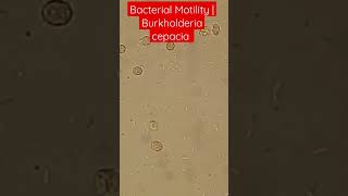 Bacterial Motility Burkholderia cepacia Blood Culture bacteremia [upl. by Remy]