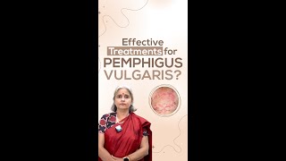 Effective Treatments for Pemphigus Vulgaris [upl. by Pihc726]