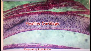 Histology of Trachea [upl. by Harbour]