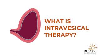 What is Intravesical Therapy  Bladder Cancer Advocacy Network [upl. by Xel]