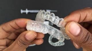 How to use Tooth Whitening Trays [upl. by Wiltz243]