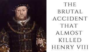 The BRUTAL Accident That Almost Killed Henry VIII [upl. by Dulla]