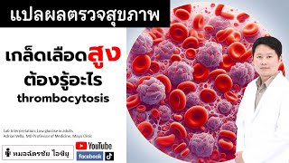 เกล็ดเลือดสูง เกิดจากอะไร ทำอย่างไร เกล็ดเลือดสูง thrombocytosis cbcผิดปกติ [upl. by Jentoft12]