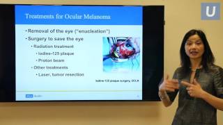 Uveal Melanoma A Modern Approach to Ocular Oncology  Tara McCannel MD  UCLAMDChat [upl. by Fabrianne]