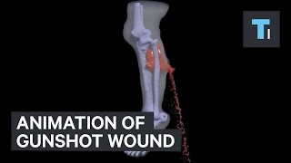 Animation of gunshot wound [upl. by Retloc987]