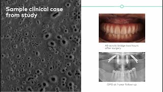 Xeal amp TiUltra The clinically proven surfaces [upl. by Rocher]