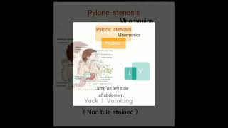 🦅 PYLORIC STENOSIS Mnemonic 🕊 [upl. by Ardnalahs]