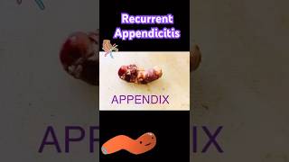 APPENDIX [upl. by Tabb]