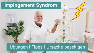 Impingement Syndrom Schulter ✅ Übungen  Tipps  Lösung [upl. by Podvin859]