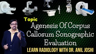 TOPICAgenesis of Corpus Callosum Sonographic evaluationLearn Radiology with Dr Anil Joshi series [upl. by Trebor]