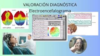 TC Resonancia magnética Electroencefalograma y punción lumbar  Función Neurológica 5 [upl. by Leunamme291]