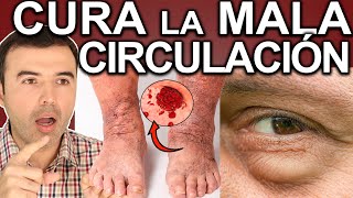 SOLUCIONA LA MALA CIRCULACIÓN  Como Mejorar La Circulacion Y Limpiar Las Arterias Y Venas [upl. by Somar504]