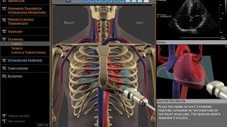 Basics of ultrasound machine [upl. by Ody]