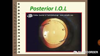 Ophthalmology Practical Slides 2 [upl. by Cj175]