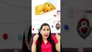 ¿Qué es la Ictericia neonatal shortsyoutube [upl. by Aneekan]