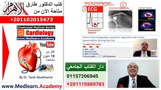 Angina Pectoris cme internalmedicine ecg usmle medical محاضراتباطنة [upl. by Anitsuga242]