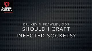 Should I Graft Infected Extraction Sockets [upl. by Nnylhtak]