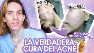 ROACCUTAN o ACCUTANE Efectos adversos como tomarla antes y despues LA VERDAD de la ISOTRETINOINA [upl. by Blackmore863]