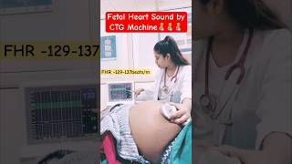 fetal heart sound by CTG machineroutine care [upl. by Darmit280]