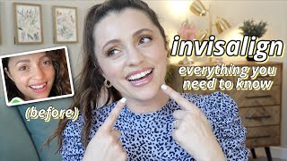 INVISALIGN REVIEW Im Done The exact cost was it worth it beforeduringafter photos my advice [upl. by Enaenaj]