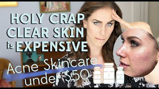 Acne Skincare Routine Drugstore Under 50 For Teenage Acne [upl. by Derwon665]