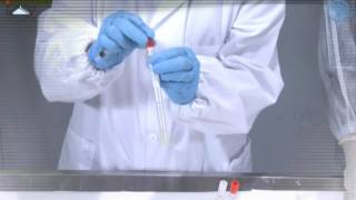 Sample collection in live birds blood tracheal and cloacal swat [upl. by Bloxberg119]