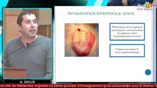 Occlusion intestinale aigue  diagnostic et traitement N SIFOUR D BENAIBOUCHE [upl. by Lucias330]