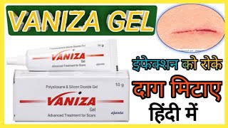 Vaniza gel  vaniza gel की फायदे  vaniza gel की जानकारी हिंदी में पूरा वीडियो देखें [upl. by Goodspeed]